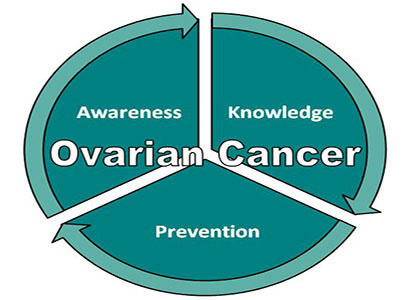 Ovarian cancer,Symptoms of Ovarian Cancer,Confusable Diseases with Ovarian Cancer