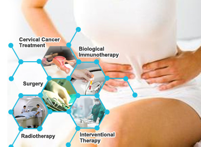 cervical cancer, cervical cancer treatment