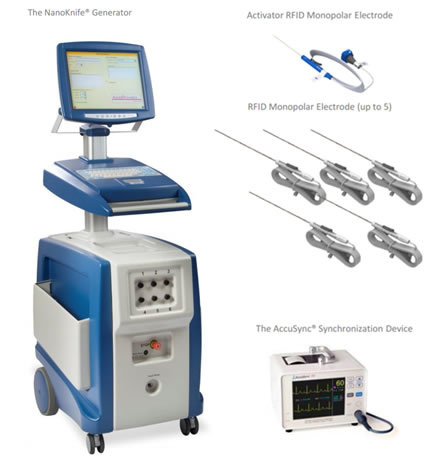 nanoknife technology, tumor ablation technology, cancer, cancer treatment, Modern Cancer Hospital Guangzhou, pancreatic cancer