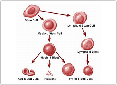 leukemia, symptoms of leukemia