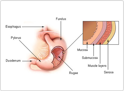 stomach cancer, stomach cancer symptoms