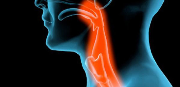 laryngeal cancer, laryngeal cancer symptoms, laryngeal cancer diagnosis, laryngeal cancer treatment