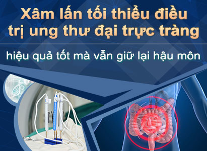 Xâm lấn tối thiểu điều trị ung thư đại trực tràng, hiệu quả tốt mà vẫn giữ lại hậu môn