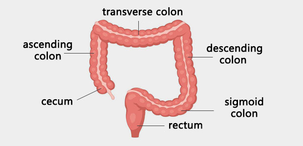 Colorectal cancer, colon cancer, rectal cancer, colorectal case report, St.Stamford Modern Cancer Hospital Guangzhou