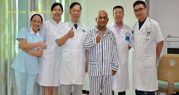 Kanker Usus Besar, Pengobatan Kanker Usus Besar, Kanker Usus Besar Metastasis Hati, Nanoknife, St. Stamford Modern Cancer Hospital Guangzhou