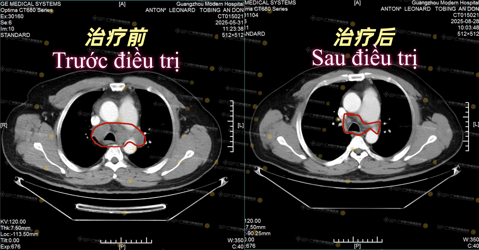 1-085644919.png 1-085644919.png