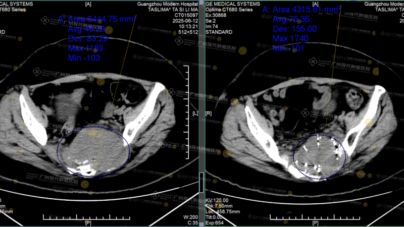 1-083536166.png 图片3.png