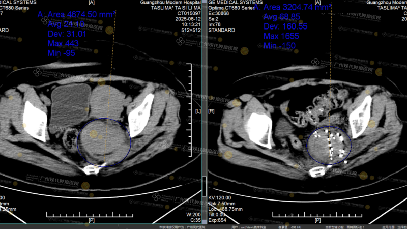 1-083548501.png 图片4.png