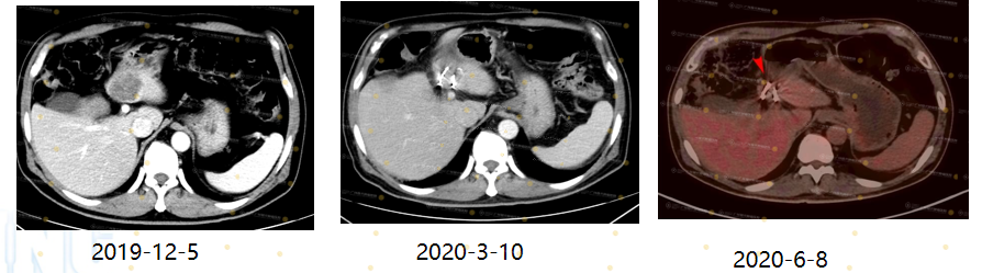 1-090536632.png 1-090536632.png