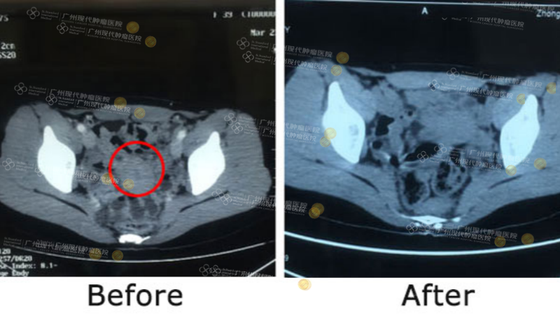 1-033153211.png 2.png