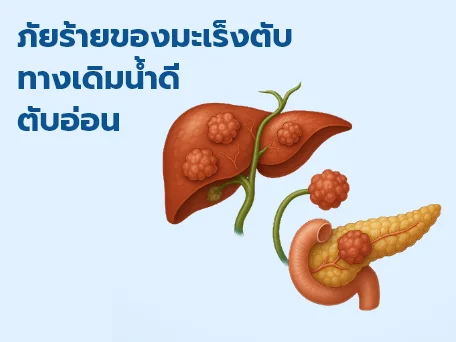 เทคโนโลยีการรักษาแบบแผลเล็ก: อาวุธอันแม่นยำในการรักษาโรคตับ ถุงน้ำดี และตับอ่อน