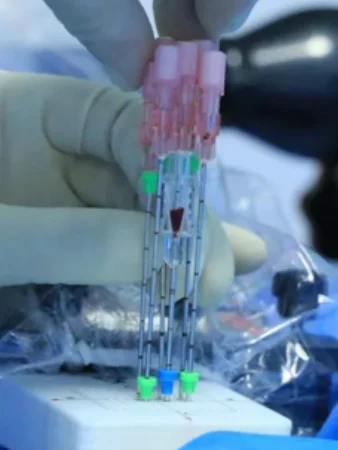 ทำไมถึงเลือกโรงพยาบาลมะเร็งสมัยใหม่กว่างโจว #2