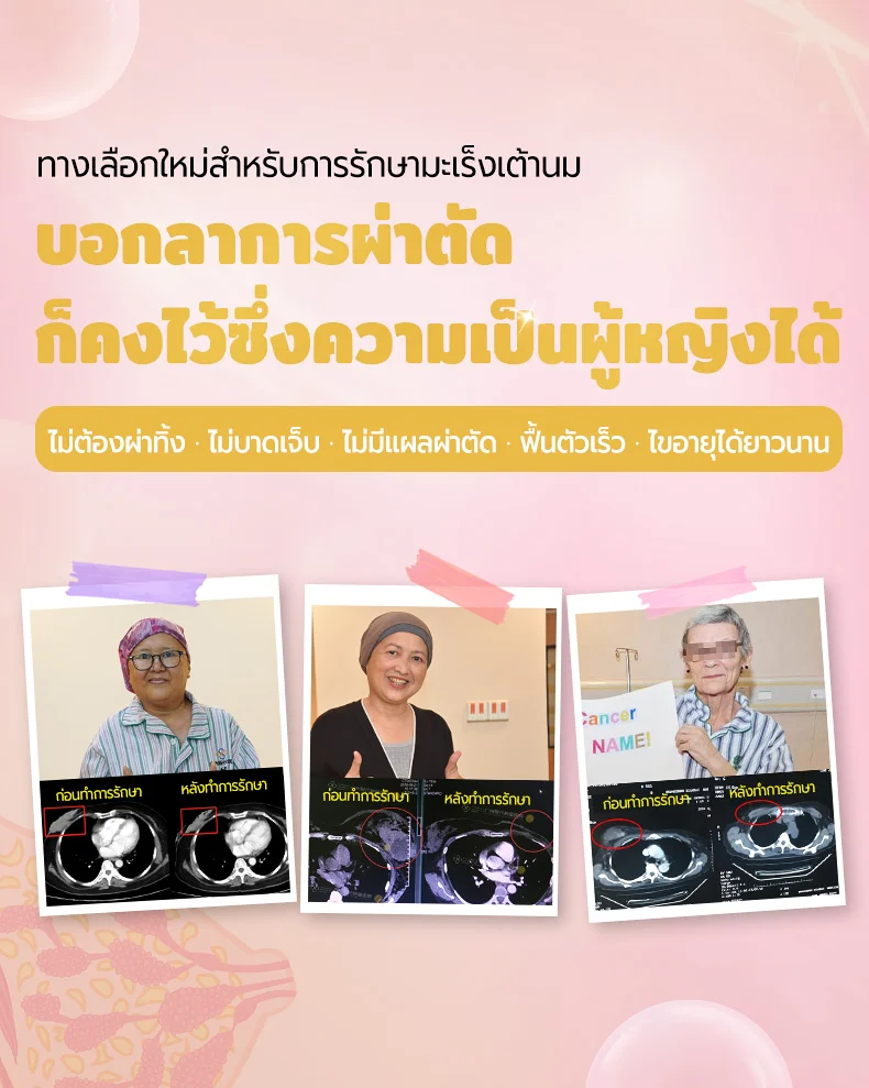 乳腺癌案例专题