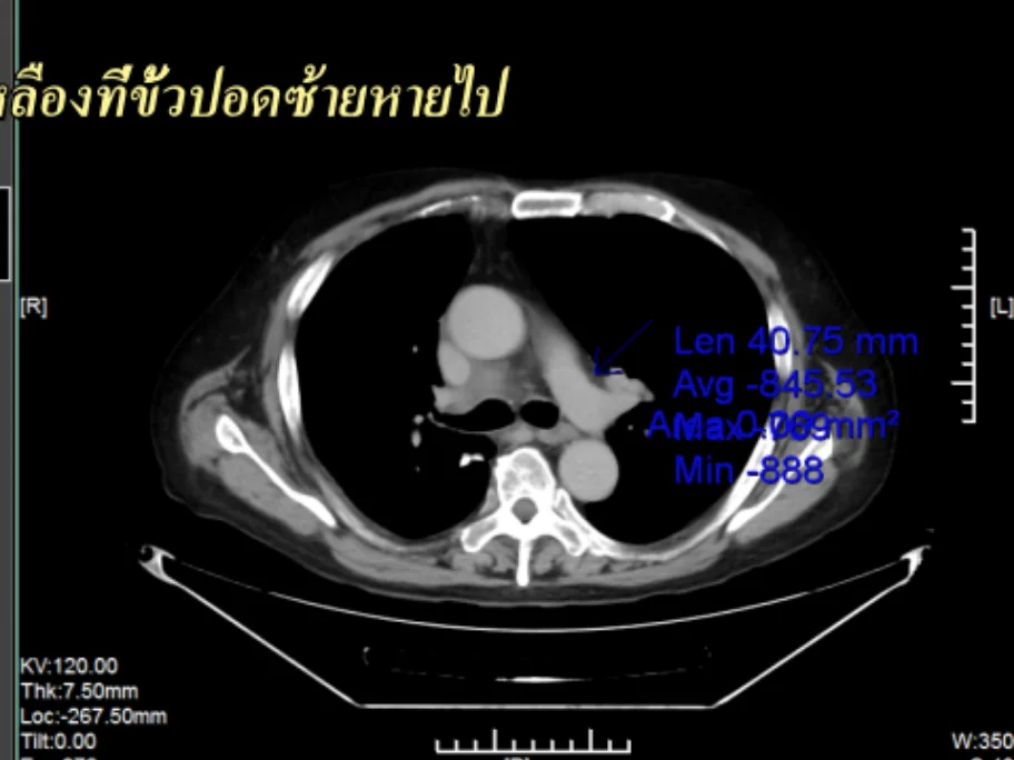 Medical scan after treatment