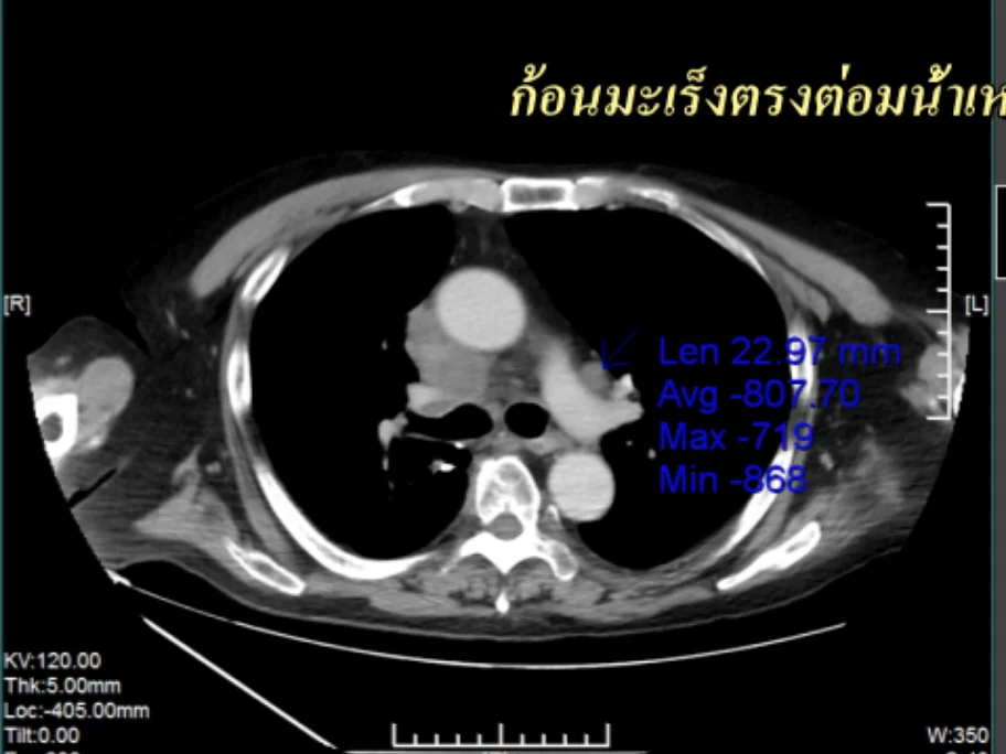 Medical scan before treatment