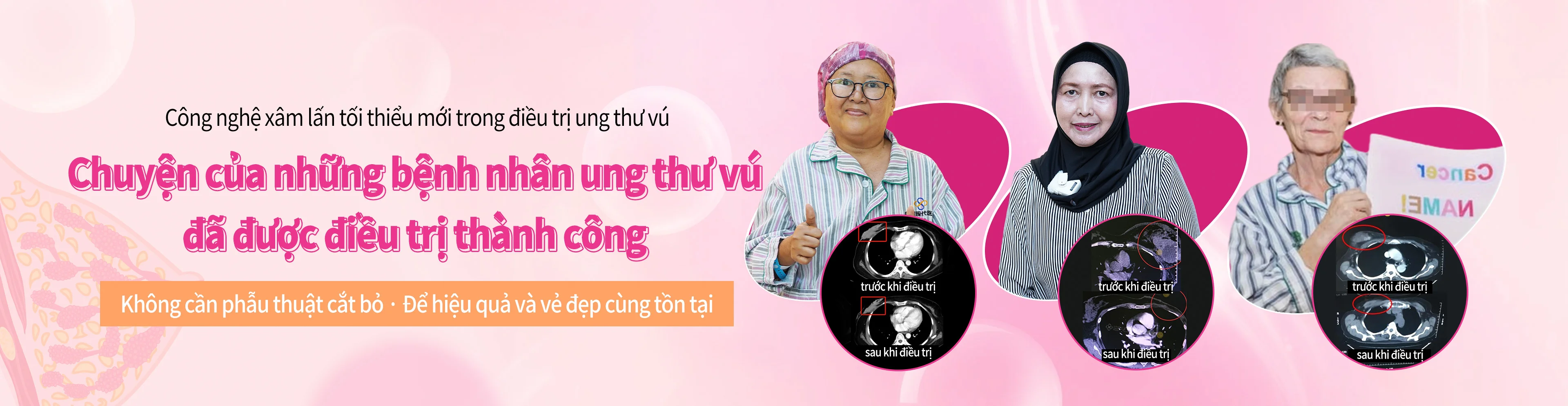 乳腺癌患者故事合集
