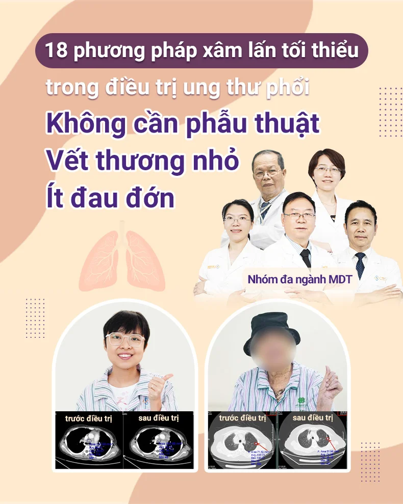 肺癌患者故事合集12.7