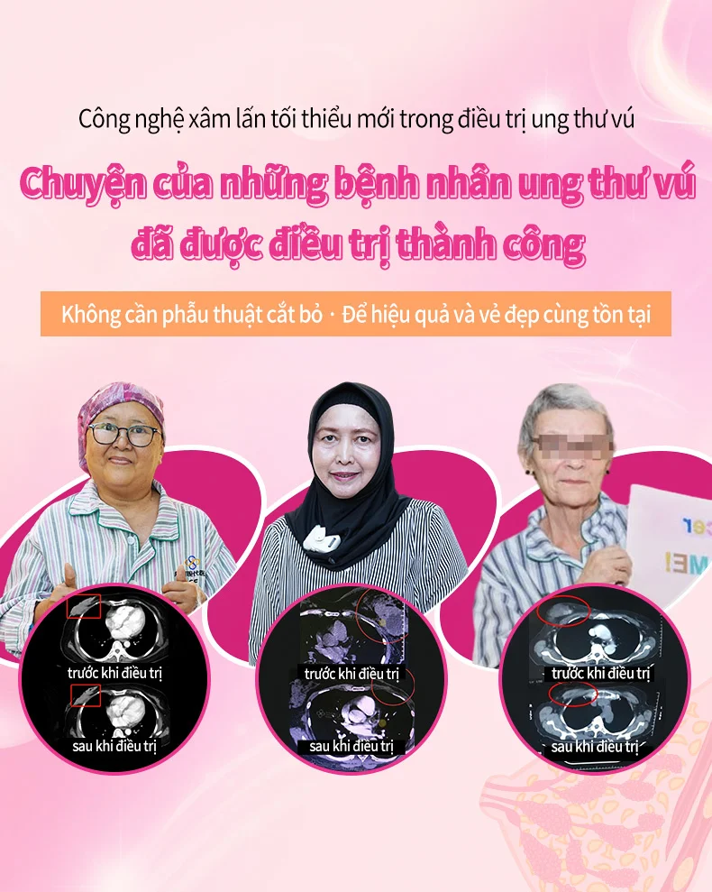 乳腺癌患者故事合集