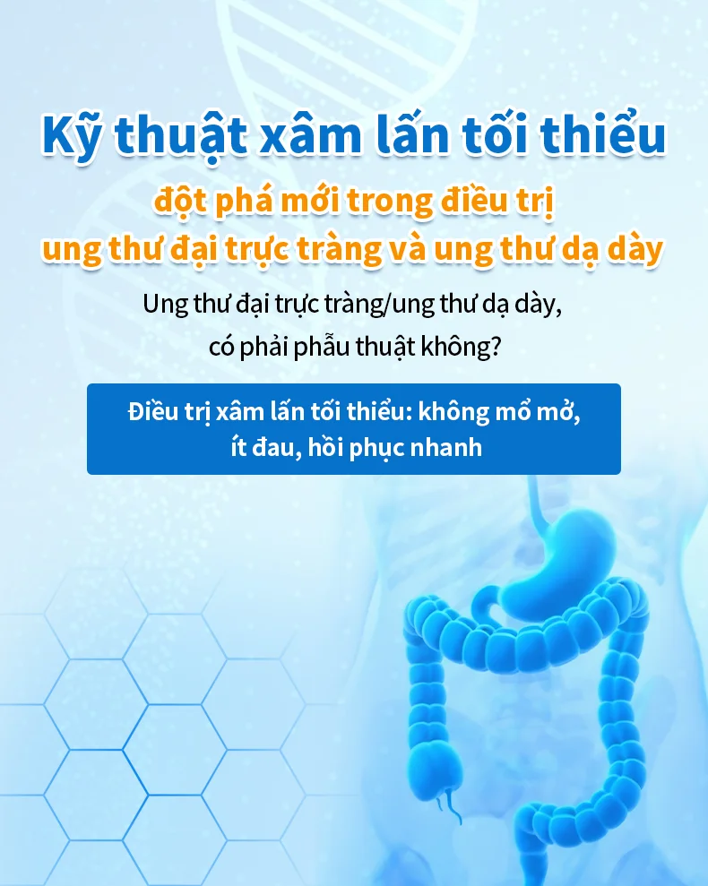 Kỹ thuật xâm lấn tối thiểu mở ra bước đột phá mới  trong điều trị ung thư đại trực tràng và ung thư dạ dày.