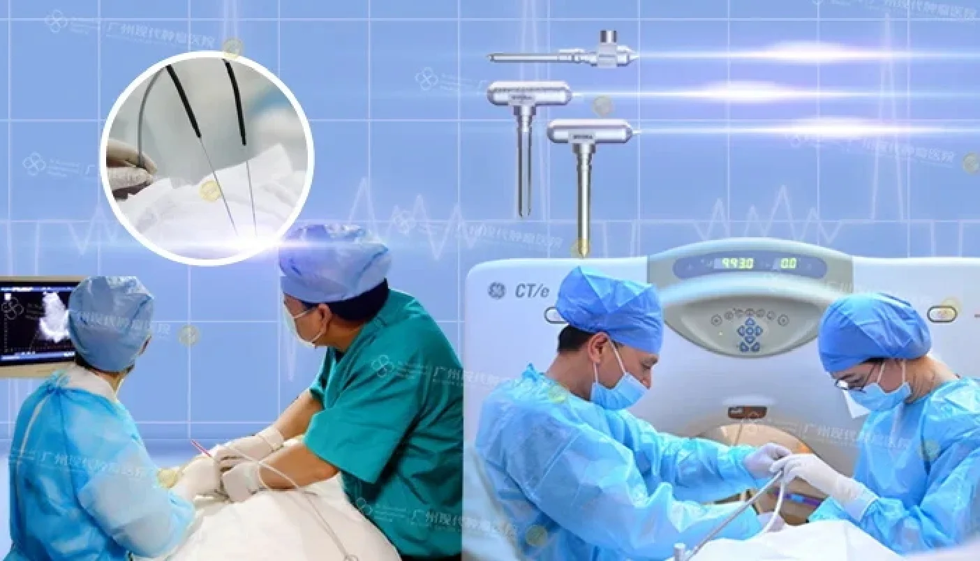 Liệu pháp Cấy hạt phóng xạ