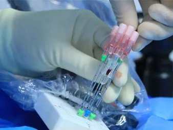 Liệu pháp Cấy hạt phóng xạ