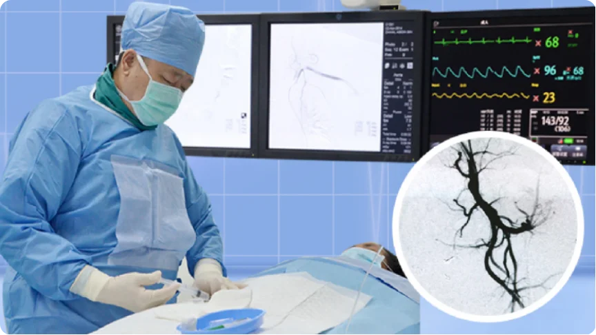 Nút mạch nhắm trúng đích: Điều trị can thiệp nút mạch ít xâm lấn