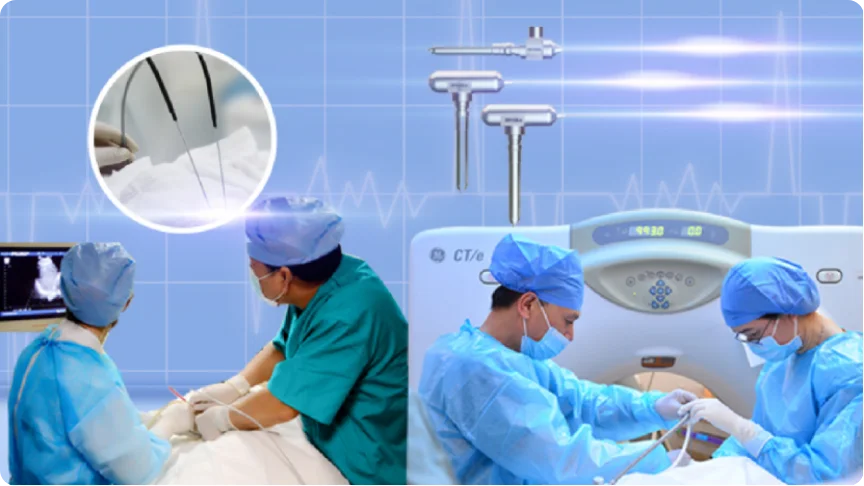 Đốt u chính xác tại chỗ: Kỹ thuật áp lạnh tiêu hủy khối u