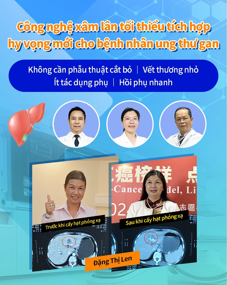 Trang chủ đề điều trị ung thư