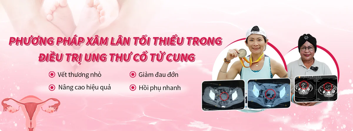 18 phương pháp điều trị xâm lấn tối thiểu – Tin vui cho bệnh nhân ung thư cổ tử