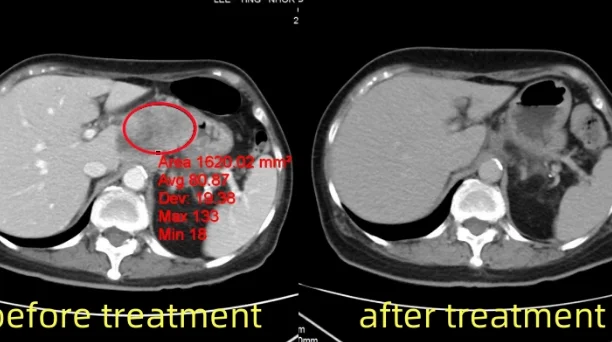 Ảnh chụp CT cắt lớp vi tính