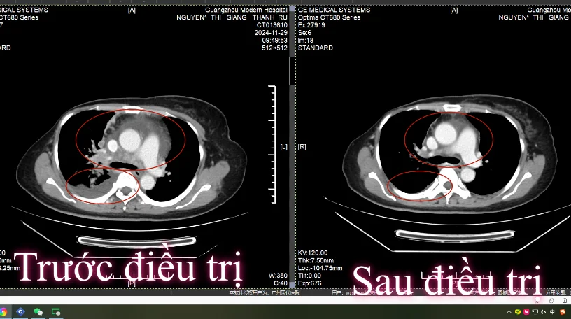 Ảnh chụp CT cắt lớp vi tính
