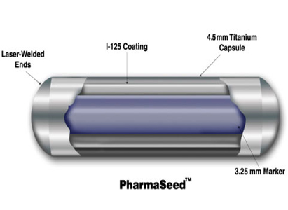 المعالجة الإشعاعية الداخلية بزراعة جسيمات اليود 125 المشع(125I)