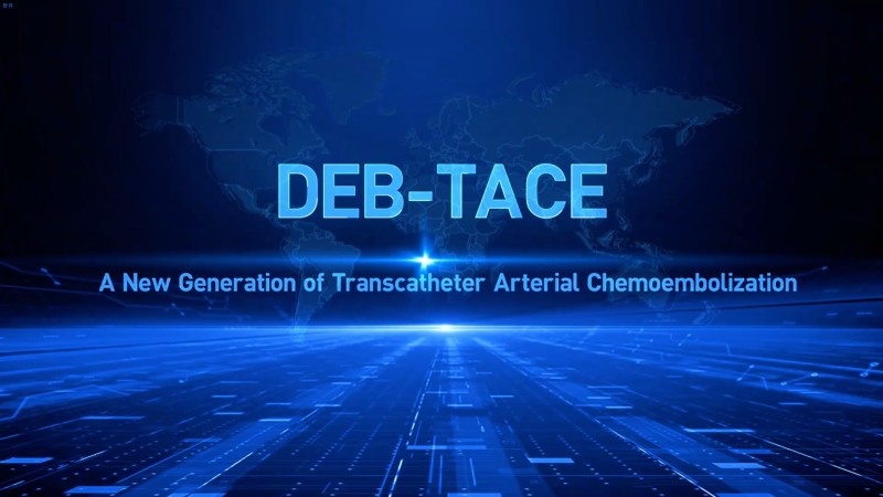 DEB-TACE: A New Generation of Transcatheter Arterial Chemoembolization (TACE)