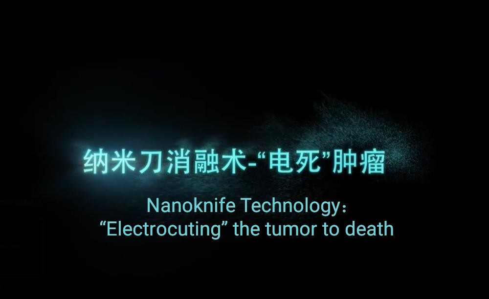 Nanoknife:a brand-new cutting-edge ablation technology for tumor treatment