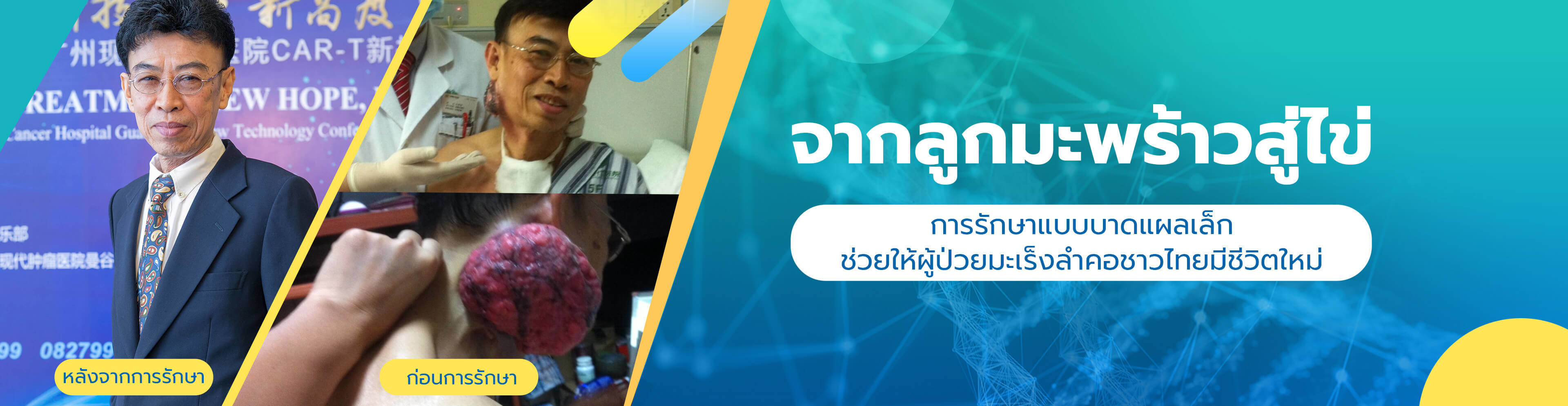 https://www.moderncancerthai.com/banner/7154.html