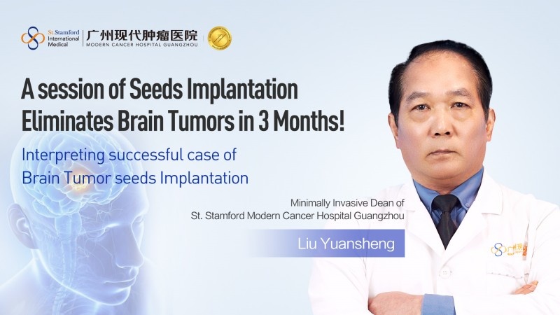 A session of Seeds Implantation Eliminates Brain Tumors in 3 Months