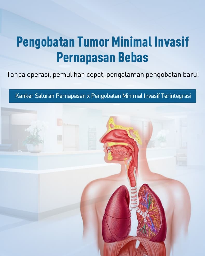 Pengobatan,kanker,saluran,pernapasan,Pengobatan,kanker,