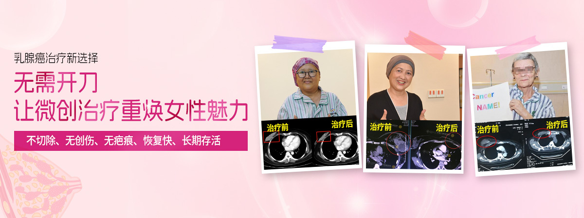 乳腺癌治疗新选择——无需开刀，让微创治疗重焕女性魅力