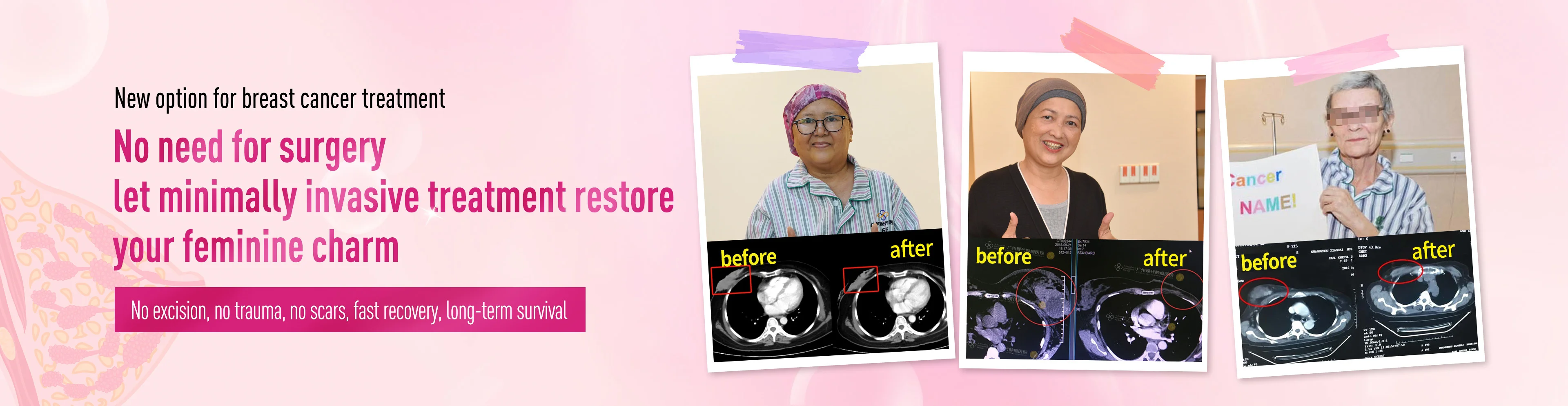 https://www.moderncancerhospitalmy.com/banner/2024/0730/8225.html