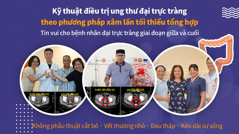 Kỹ thuật điều trị ung thư đại trực tràng theo phương pháp xâm lấn tối thiểu