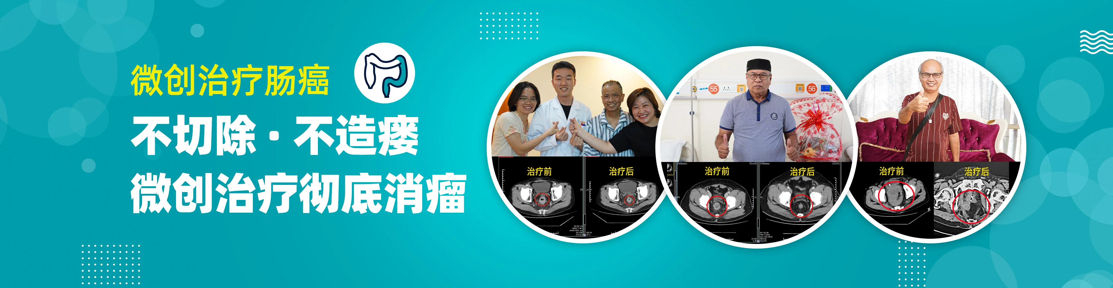 https://www.moderncancerhospitalmy.com/cn/banner/cn/8236.html