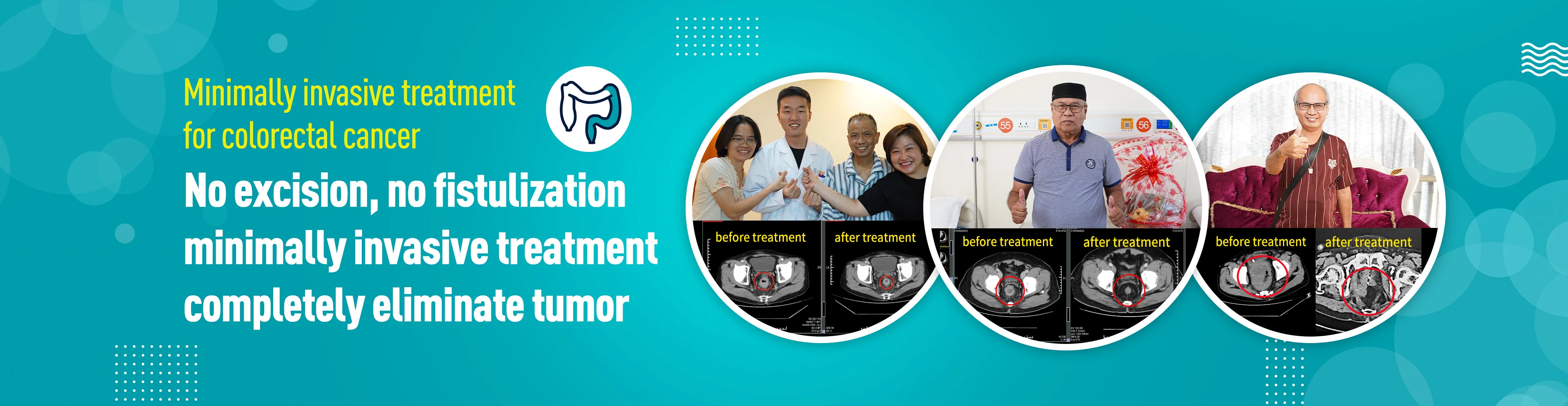 https://www.moderncancerhospitalmy.com/banner/2024/0816/8240.html