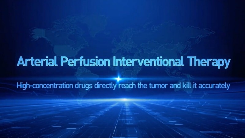 Arterial Perfusion Interventional Therapy: High-concentration drugs directly reach the tumor and kill it accurately