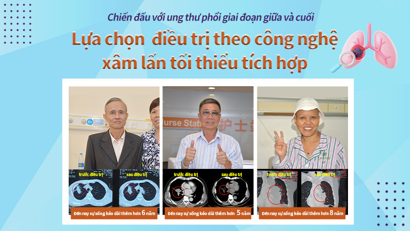 Chiến đấu với ung thư phổi giai đoạn giữa và cuối - Lựa chọn phương pháp điề