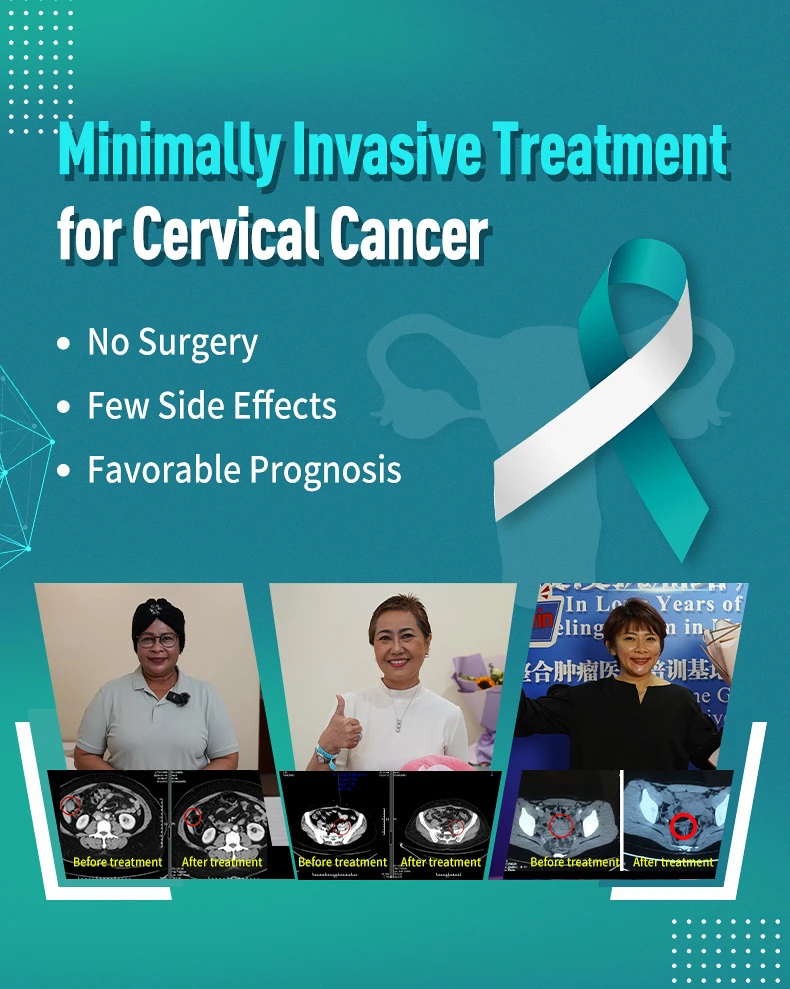 Minimally Invasive Treatments f