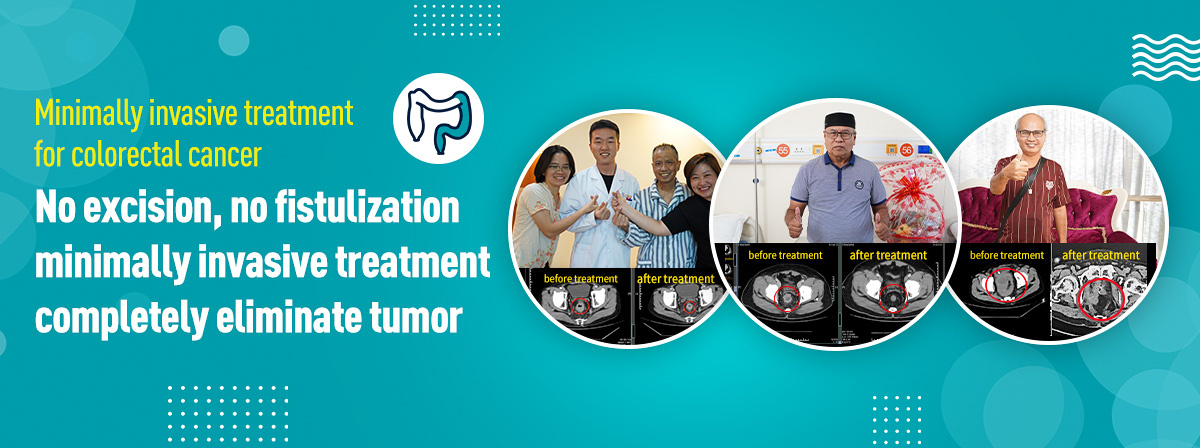 Minimally invasive treatment for colorectal cancer