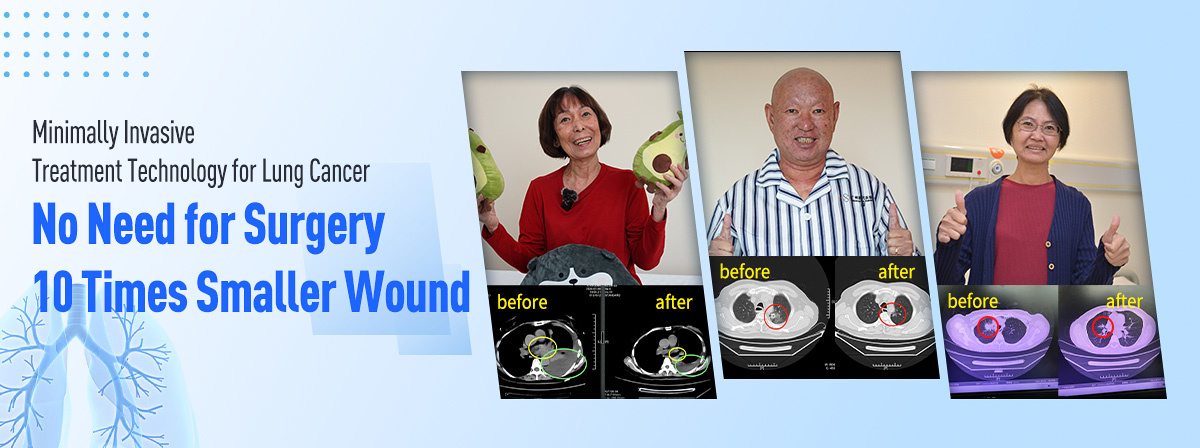 Minimally Invasive Treatment Technology for Lung Cancer– No Need for Surgery, 10 Times Smaller Wound