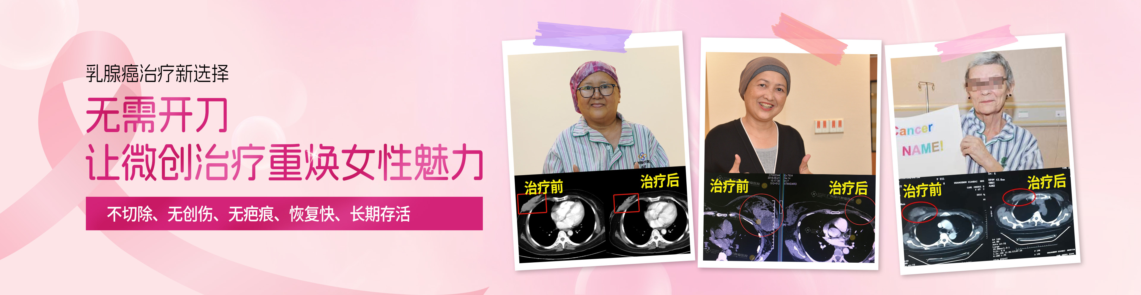 https://www.moderncancerhospitalmy.com/cn/banner/cn/8207.html