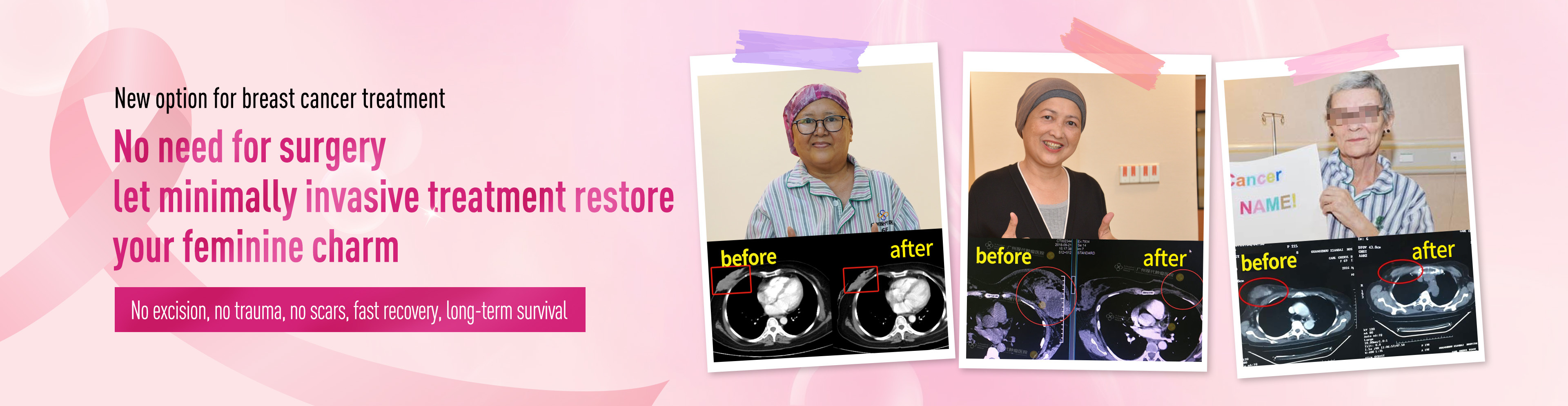 https://www.moderncancerhospitalmy.com/banner/2024/0730/8225.html