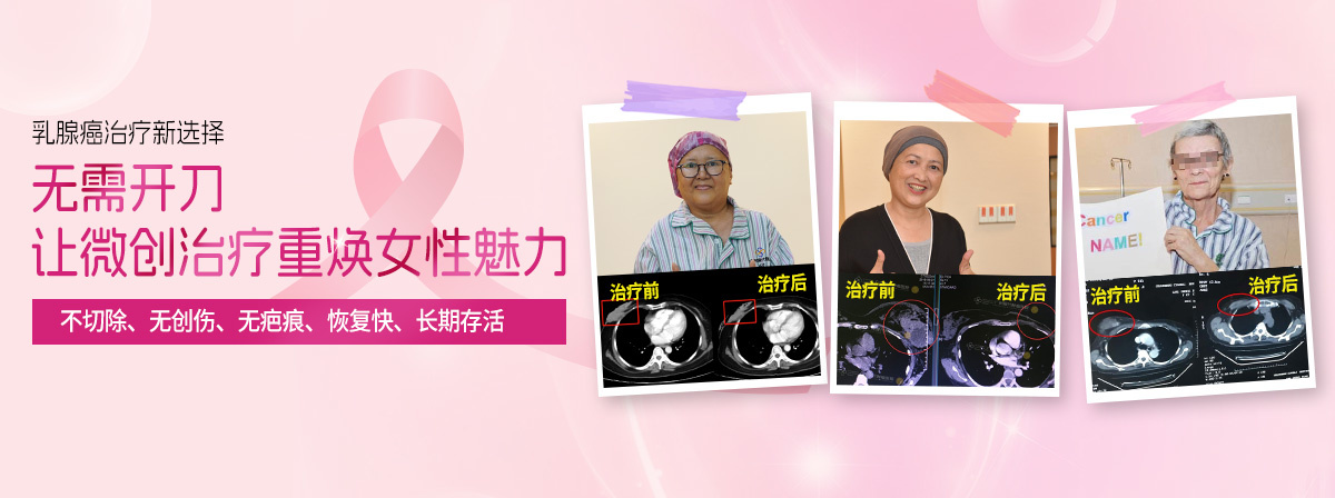 乳腺癌治疗新选择——无需开刀，让微创治疗重焕女性魅力